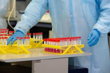 FEM e APSS: “Massima sicurezza nei laboratori di analisi”