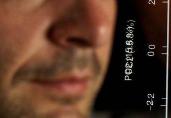 N. 1 (una) posizione a tempo determinato per n. 36 mesi di Ricercatore di terza fascia nel settore della biostatistica ed analisi dati (187_CRI_BAD)...